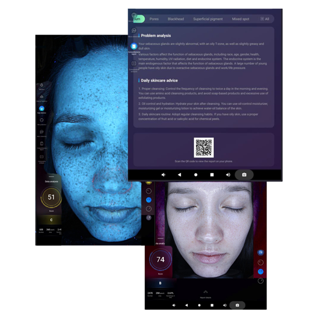 Pure Tone Derma Vu skin analysis before and after